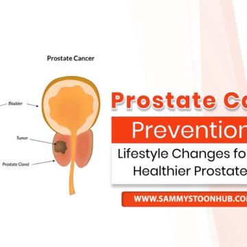 Prostate Cancer Prevention: A Guide to Risk Reduction.